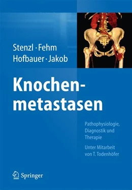 Abbildung von Stenzl / Fehm | Knochenmetastasen | 1. Auflage | 2014 | beck-shop.de