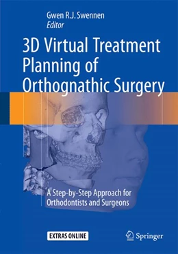 Abbildung von Swennen | 3D Virtual Treatment Planning of Orthognathic Surgery | 1. Auflage | 2016 | beck-shop.de