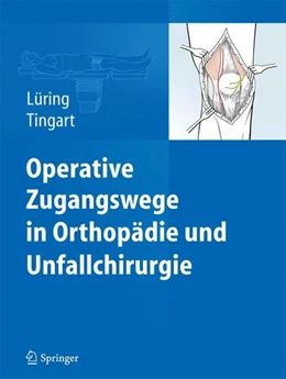 Abbildung von Lüring / Tingart | Operative Zugangswege in Orthopädie und Unfallchirurgie | 1. Auflage | 2015 | beck-shop.de