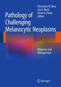 Abbildung von Shea / Reed | Pathology of Challenging Melanocytic Neoplasms | 1. Auflage | 2014 | beck-shop.de