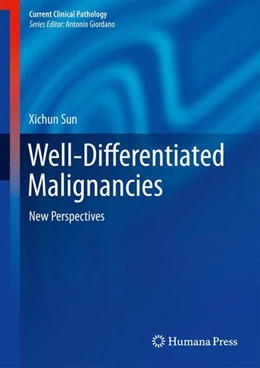 Abbildung von Sun | Well-Differentiated Malignancies | 1. Auflage | 2014 | beck-shop.de