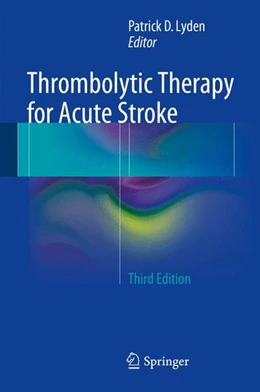 Abbildung von Lyden | Thrombolytic Therapy for Acute Stroke | 3. Auflage | 2014 | beck-shop.de
