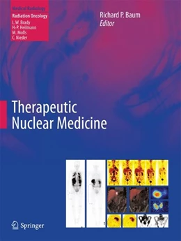 Abbildung von Baum | Therapeutic Nuclear Medicine | 1. Auflage | 2014 | beck-shop.de
