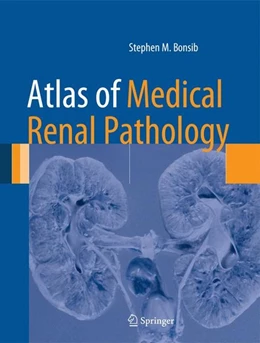 Abbildung von Bonsib | Atlas of Medical Renal Pathology | 1. Auflage | 2014 | beck-shop.de