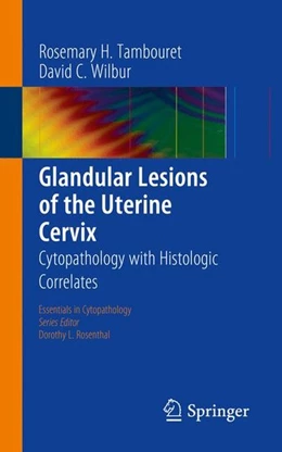 Abbildung von Tambouret / Wilbur | Glandular Lesions of the Uterine Cervix | 1. Auflage | 2014 | beck-shop.de