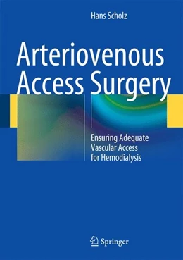 Abbildung von Scholz | Arteriovenous Access Surgery | 1. Auflage | 2014 | beck-shop.de