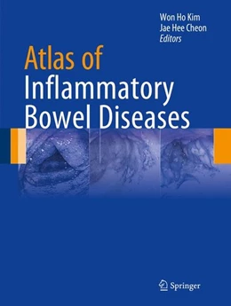 Abbildung von Kim / Cheon | Atlas of Inflammatory Bowel Diseases | 1. Auflage | 2015 | beck-shop.de