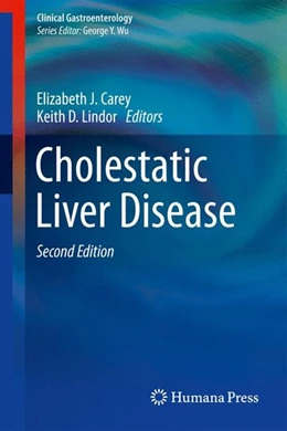 Abbildung von Carey / Lindor | Cholestatic Liver Disease | 2. Auflage | 2014 | beck-shop.de