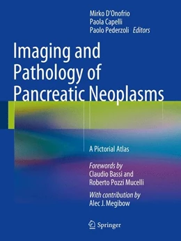 Abbildung von D'Onofrio / Capelli | Imaging and Pathology of Pancreatic Neoplasms | 1. Auflage | 2014 | beck-shop.de