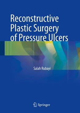 Abbildung von Rubayi | Reconstructive Plastic Surgery of Pressure Ulcers | 1. Auflage | 2015 | beck-shop.de