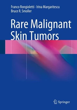 Abbildung von Rongioletti / Margaritescu | Rare Malignant Skin Tumors | 1. Auflage | 2014 | beck-shop.de