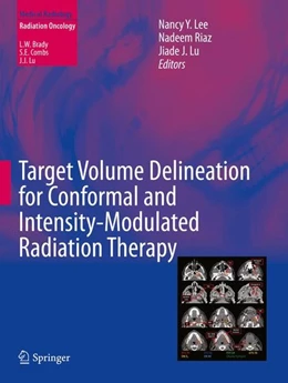 Abbildung von Lee / Riaz | Target Volume Delineation for Conformal and Intensity-Modulated Radiation Therapy | 1. Auflage | 2014 | beck-shop.de