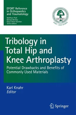 Abbildung von Knahr | Tribology in Total Hip and Knee Arthroplasty | 1. Auflage | 2014 | beck-shop.de