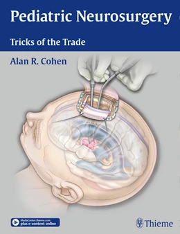 Abbildung von Cohen | Pediatric Neurosurgery: Tricks of the Trade | 1. Auflage | 2015 | beck-shop.de
