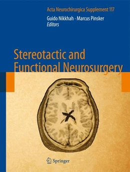 Abbildung von Nikkhah / Pinsker | Stereotactic and Functional Neurosurgery | 1. Auflage | 2014 | beck-shop.de