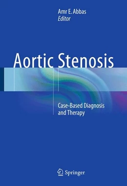 Abbildung von Abbas | Aortic Stenosis | 1. Auflage | 2015 | beck-shop.de