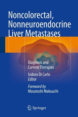 Abbildung von Di Carlo | Noncolorectal, Nonneuroendocrine Liver Metastases | 1. Auflage | 2014 | beck-shop.de