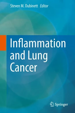 Abbildung von Dubinett | Inflammation and Lung Cancer | 1. Auflage | | beck-shop.de