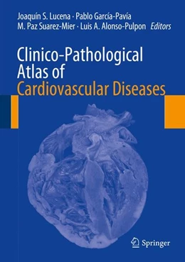 Abbildung von Lucena / García-Pavía | Clinico-Pathological Atlas of Cardiovascular Diseases | 1. Auflage | 2014 | beck-shop.de