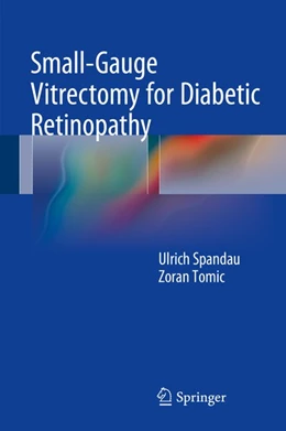 Abbildung von Spandau | Small-Gauge Vitrectomy for Diabetic Retinopathy | 1. Auflage | 2015 | beck-shop.de