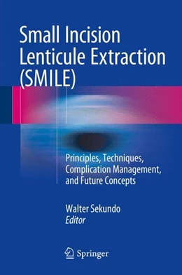 Abbildung von Sekundo | Small Incision Lenticule Extraction (SMILE) | 1. Auflage | 2015 | beck-shop.de