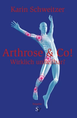 Abbildung von Schweitzer | Arthrose & Co - Wirklich unheilbar? | 1. Auflage | 2015 | beck-shop.de