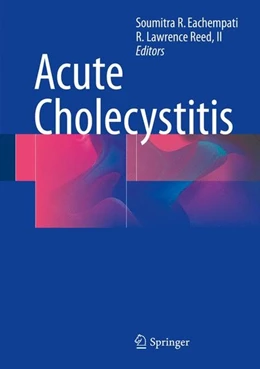 Abbildung von Eachempati / Reed | Acute Cholecystitis | 1. Auflage | 2015 | beck-shop.de