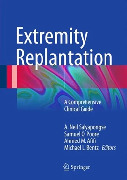 Abbildung von Salyapongse / Poore | Extremity Replantation | 1. Auflage | 2014 | beck-shop.de