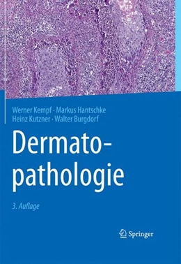 Abbildung von Kempf / Hantschke | Dermatopathologie | 3. Auflage | 2015 | beck-shop.de