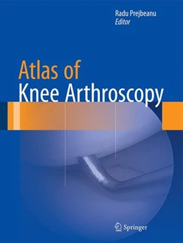 Abbildung von Prejbeanu | Atlas of Knee Arthroscopy | 1. Auflage | 2014 | beck-shop.de