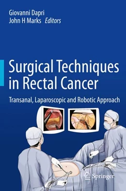 Abbildung von Dapri / Marks | Surgical Techniques in Rectal Cancer | 1. Auflage | 2018 | beck-shop.de