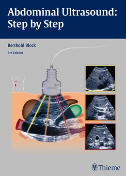 Abbildung von Block | Abdominal Ultrasound: Step by Step | 3. Auflage | 2015 | beck-shop.de