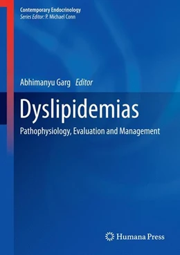 Abbildung von Garg | Dyslipidemias | 1. Auflage | 2015 | beck-shop.de