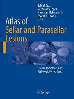 Abbildung von Zada / Lopes | Atlas of Sellar and Parasellar Lesions | 1. Auflage | 2015 | beck-shop.de