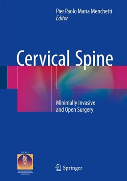 Abbildung von Menchetti | Cervical Spine | 1. Auflage | 2015 | beck-shop.de