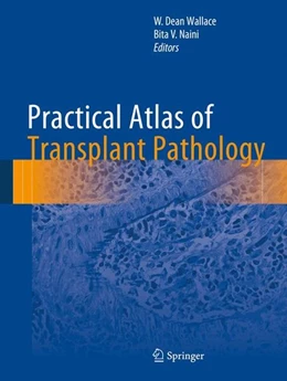 Abbildung von Wallace / Naini | Practical Atlas of Transplant Pathology | 1. Auflage | 2015 | beck-shop.de