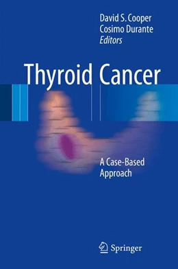 Abbildung von Cooper / Durante | Thyroid Cancer | 1. Auflage | 2015 | beck-shop.de