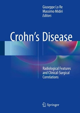 Abbildung von Lo Re / Midiri | Crohn's Disease | 1. Auflage | 2015 | beck-shop.de