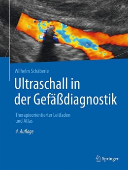 Abbildung von Schäberle | Ultraschall in der Gefäßdiagnostik | 4. Auflage | 2015 | beck-shop.de