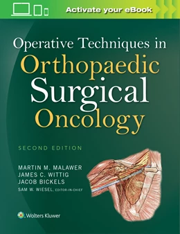 Abbildung von Malawer / WITTIG | Operative Techniques in Orthopaedic Surgical Oncology | 2. Auflage | 2016 | beck-shop.de