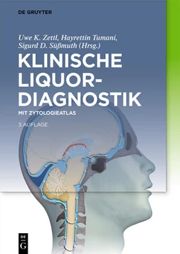Abbildung von Zettl / Tumani | Klinische Liquordiagnostik | 3. Auflage | 2021 | beck-shop.de