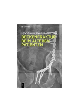 Abbildung von Culemann / Pohlemann | Beckenfraktur beim älteren Patienten | 1. Auflage | 2021 | beck-shop.de