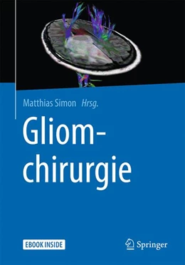 Abbildung von Simon (Hrsg.) | Gliomchirurgie | 1. Auflage | 2017 | beck-shop.de