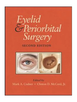 Abbildung von Codner, MD / McCord, Jr., MD | Eyelid and Periorbital Surgery, Second Edition | 2. Auflage | 2016 | beck-shop.de