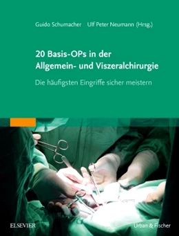 Abbildung von Schumacher / Neumann (Hrsg.) | 20 Basis-OPs in der Allgemein- und Viszeralchirurgie | 1. Auflage | 2016 | beck-shop.de
