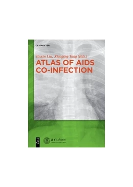 Abbildung von Jinxin / Xiaoping | Atlas of AIDS Co-infection | 1. Auflage | 2015 | beck-shop.de