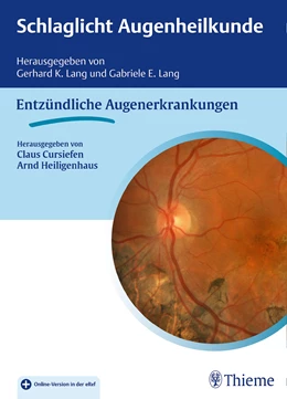 Abbildung von Cursiefen / Heiligenhaus (Hrsg.) | Schlaglicht Augenheilkunde: Entzündliche Augenerkrankungen | 1. Auflage | 2016 | beck-shop.de