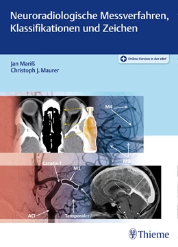 Abbildung von Mariß / Maurer | Neuroradiologische Messverfahren, Klassifikationen und Zeichen | 1. Auflage | 2022 | beck-shop.de