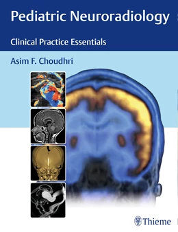 Abbildung von Choudhri | Pediatric Neuroradiology | 1. Auflage | 2016 | beck-shop.de