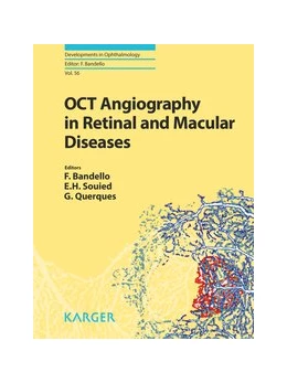 Abbildung von Bandello / Souied | OCT Angiography in Retinal and Macular Diseases | 1. Auflage | 2016 | beck-shop.de